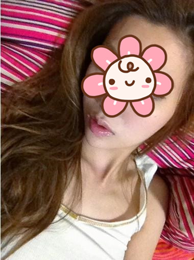 丰唇消肿后美照