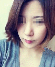 术后
