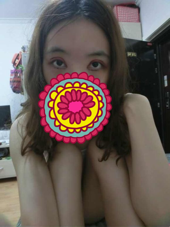 双眼皮手术的案例