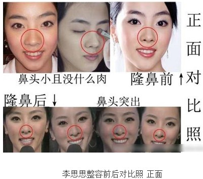 李思思