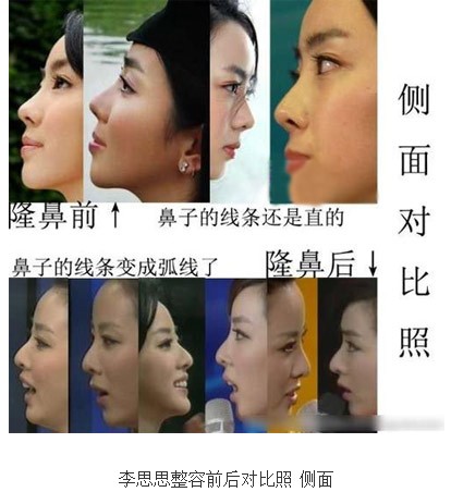 李思思