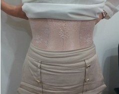 腰腹吸脂术后