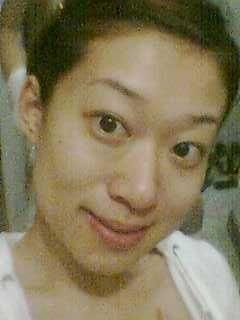手术后第20天