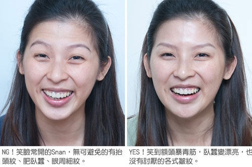 Snan表情纹严重